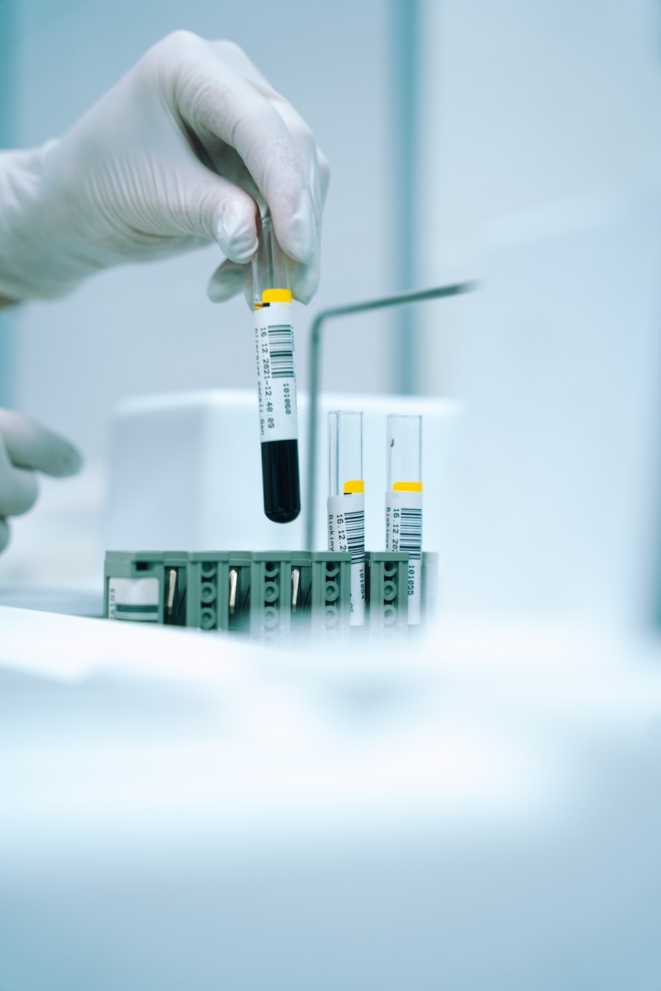 Blutprobe im Labor zur Analyse von Mikronährstoffen, Vitaminen, Hormonen und Stoffwechselwerten